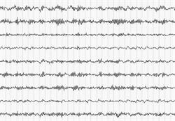 Hilt Consulting. EEG, EEG Biofeedback. Drożdżyk B.