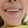 dentystyczne rtg zęba, prześwietlenie zęba, ortodoncja, implanty zębów, dentyści