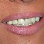 stomatolog, dentysta, leczenie zębów, dentysta dziecięcy, chirurgia stomatologiczna