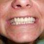 dobry gabinet stomatologiczny, tani dentysta, dobry dentysta, chirurgia stomatologiczna