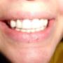 pogotowie stomatologiczne, lekarz dentysta, stomatologia, protezy zębowe