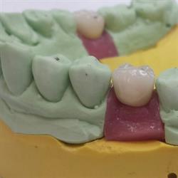 Korona-Dental Sc. Pracownia Techniki Dentystycznej