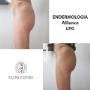 Endermologia Alliance LPG efekty zabiegu