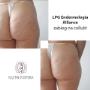 Zabieg na cellulit Endermologia Allliance