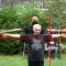 jak rozpoznawać osobę z Zespołem Marfana