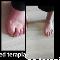 Efekty-terapii-stopy