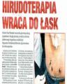 STAWIANIE PIJAWKI PIJAWEK LEKARSKICH GDAŃSK SOPOT GDYNIA GABINET MEDNATURAL