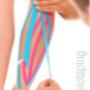 Kinesiotaping