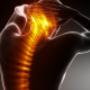 Rehabilitacja neurologiczna