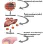 Lipoproteina