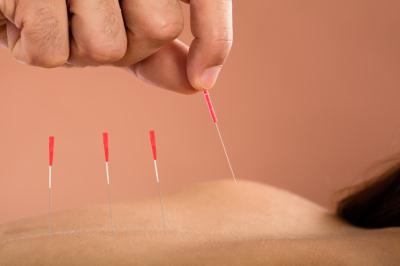 Kurs-Dry-Needling