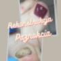 Rekonstrukcja paznokci
