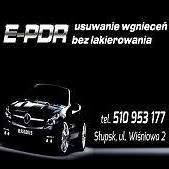 E-Pdr Usuwanie Wgnieceń