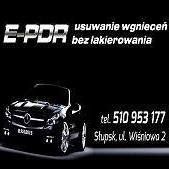 E-Pdr Usuwanie Wgnieceń