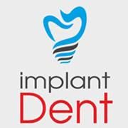 ImplantDent