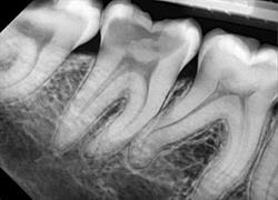 Dentidiag Ostrowskiego