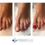 Pedicure