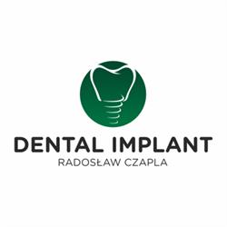 DENTAL IMPLANT Radosław Czapla