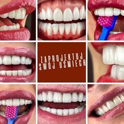 Materna Dental Klinika Stomatologiczna
