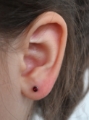 Standard Lobe