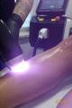 Depilacja Laserowa