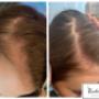 Trychologia w Kashmir Spa