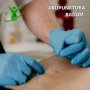 Akupunktura Radom
