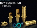 Implant stomatologiczny