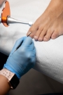 Laser Foot Treatment Clinic